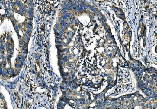 Anti-CX3CR1 Antibody Boster Bio