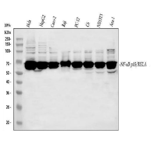 Anti-NF-κB p6/RELA Antibody Picoband® Boster Bio