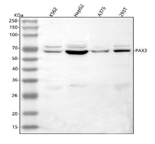 Anti-PAX3 Antibody Picoband® Boster Bio
