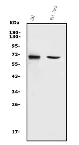 Anti-MMP2 Antibody Picoband® Boster Bio