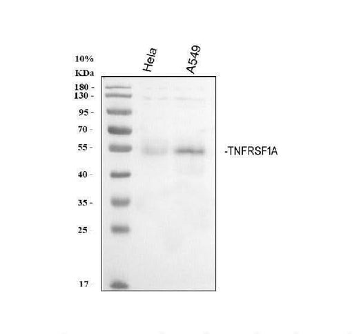 Anti-TNF Receptor I/TNFRSF1A Antibody Picoband® Boster Bio