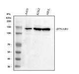Anti-IFNAR1 Antibody Picoband® Boster Bio