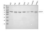 Anti-CETP Antibody Picoband® Boster Bio