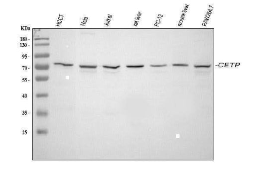 Anti-CETP Antibody Picoband® Boster Bio