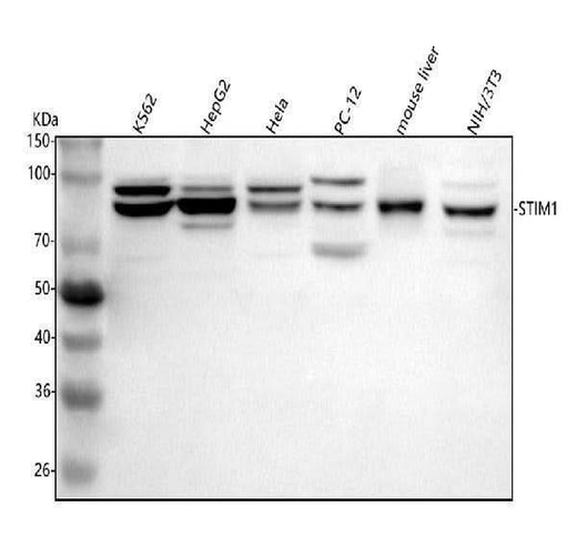 Anti-STIM1 Antibody Picoband® Boster Bio