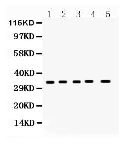 Anti-Superoxide Dismutase 4/CCS Antibody Picoband® Boster Bio