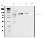 Anti-PI 3 Kinase p85 alpha/PIK3R1 Antibody Picoband® Boster Bio