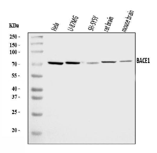 Anti-BACE1 Antibody Picoband® Boster Bio