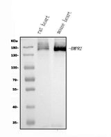 Anti-BMPR2 Antibody Picoband® Boster Bio
