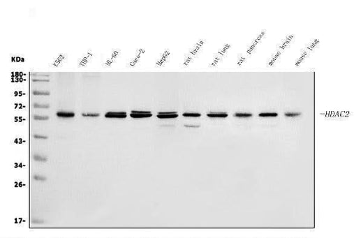 Anti-HDAC2 Antibody Picoband® Boster Bio