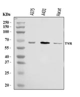 Anti-Tyrosinase/TYR Antibody Picoband® Boster Bio