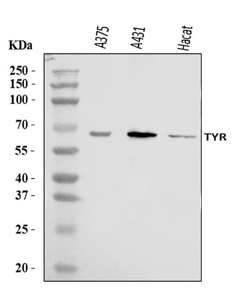 Anti-Tyrosinase/TYR Antibody Picoband® Boster Bio