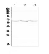 Anti-NOX2/gp91phox/CYBB Antibody Picoband® Boster Bio