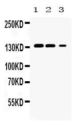 Anti-JAK1 Antibody Picoband® Boster Bio