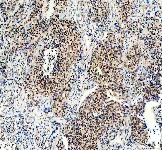 Anti-Menin/MEN1 Picoband® Antibody Boster Bio