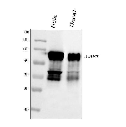 Anti-Calpastatin/CAST Antibody Picoband® Boster Bio