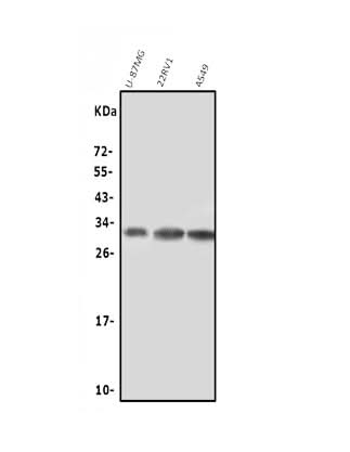 Anti-NGF Antibody Picoband® Boster Bio