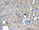 Anti-Leptin Receptor/LEPR Antibody Boster Bio