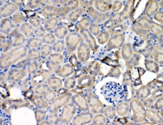 Anti-Leptin Receptor/LEPR Antibody Boster Bio