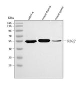 Anti-RAG2 Antibody Picoband® Boster Bio