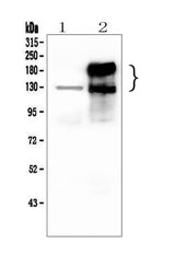 Anti-CEACAM5 Antibody Picoband® Boster Bio