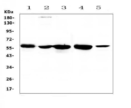 Anti-ETV6/Tel Antibody Picoband® Boster Bio