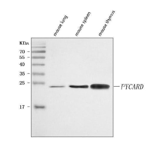 Anti-ASC/TMS1/Pycard Antibody Picoband® Boster Bio