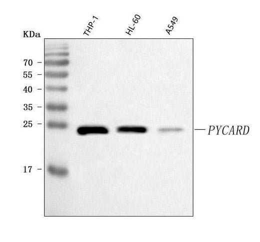 Anti-ASC/TMS1/PYCARD Antibody Picoband® Boster Bio