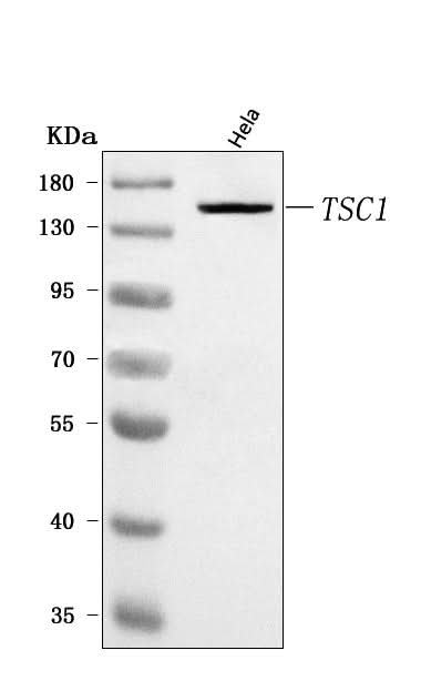 Anti-Hamartin/TSC1 Antibody Picoband® Boster Bio