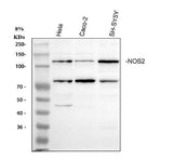 Anti-iNOS/NOS2 Antibody Picoband® Boster Bio