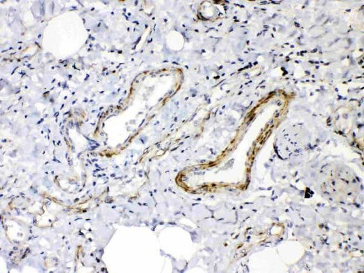 Anti-Angiopoietin-2/ANGPT2 Antibody Picoband® Boster Bio