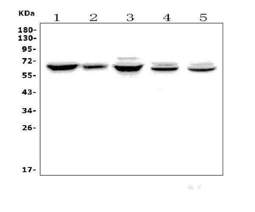Anti-Angiopoietin-2/ANGPT2 Antibody Picoband® Boster Bio
