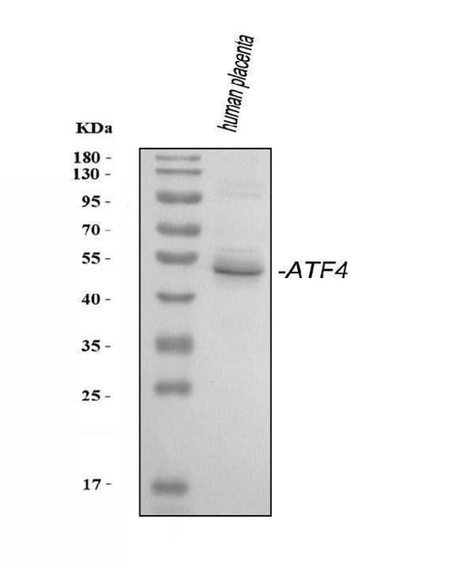 Anti-ATF4 Antibody Picoband® Boster Bio