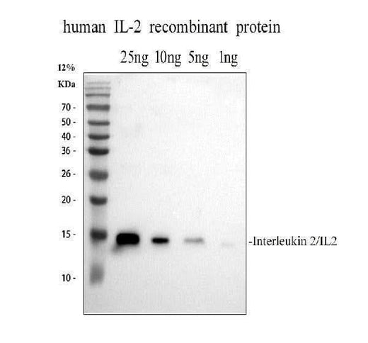 Anti-IL-2/IL2 Antibody Picoband® Boster Bio