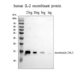 Anti-IL-2/IL2 Antibody Picoband® Boster Bio