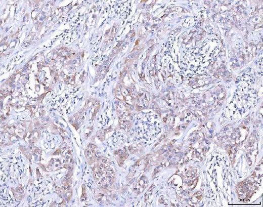Anti-CCR7 Antibody Boster Bio