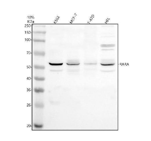 Anti-RARA Antibody Picoband® Boster Bio