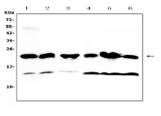 Anti-GST3/GST pi/Gstp1 Antibody Picoband® Boster Bio