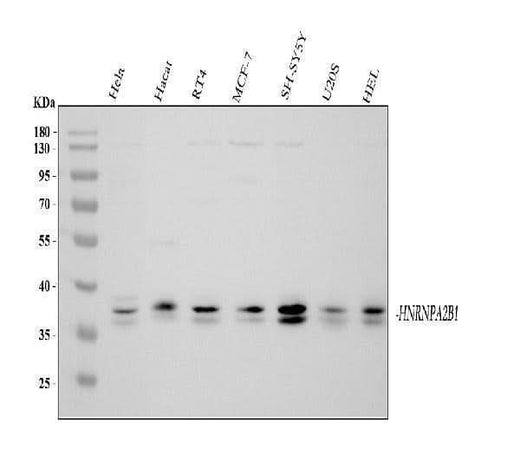 Anti-hnRNP A2B1/HNRNPA2B1 Antibody Picoband® Boster Bio