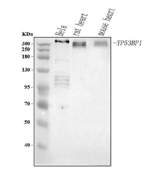 Anti-TP53BP1 Antibody Picoband® Boster Bio