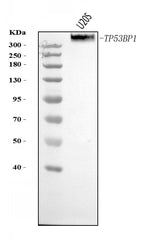 Anti-53BP1/TP53BP1 Antibody Picoband® Boster Bio