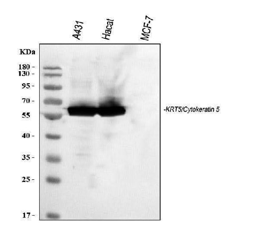 Anti-Cytokeratin 5/KRT5 Antibody Picoband® Boster Bio