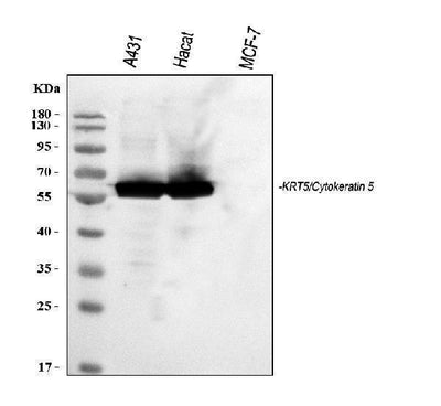 Anti-Cytokeratin 5/KRT5 Antibody Picoband® Boster Bio