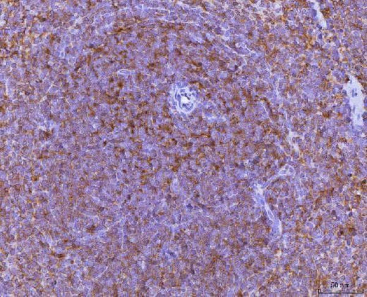 Anti-Ccl3 Antibody Boster Bio