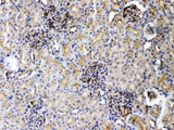 Anti-DR5/TNFRSF10B Antibody Picoband® Boster Bio