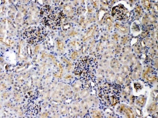 Anti-DR5/TNFRSF10B Antibody Picoband® Boster Bio