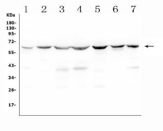 Anti-C9ORF72 Antibody Picoband® Boster Bio