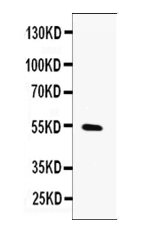 Anti-MMP13 Antibody Picoband® Boster Bio