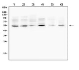 Anti-MMP13 Antibody Picoband® Boster Bio