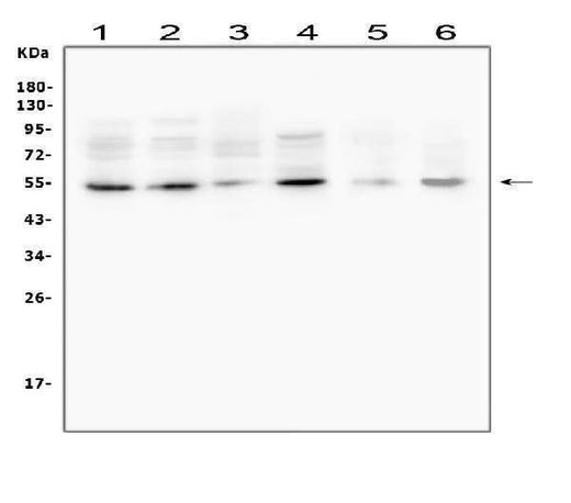 Anti-MMP13 Antibody Picoband® Boster Bio